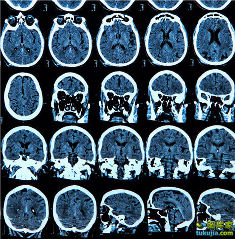 一般多久可以做一次ct jWoIH.jpg