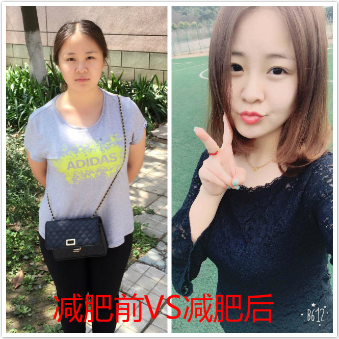 减肥案例2: 95后女大学生,3个月怒减24斤
