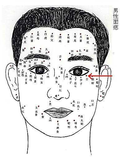 女脸上黑痣图